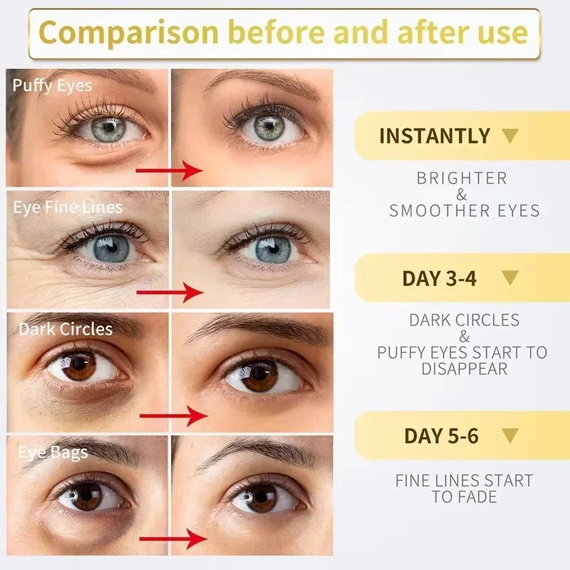 Instantly removes under eye bags, reduces fine wrinkles, improves skin elasticity, eliminates dark circles, brightens the eye ar