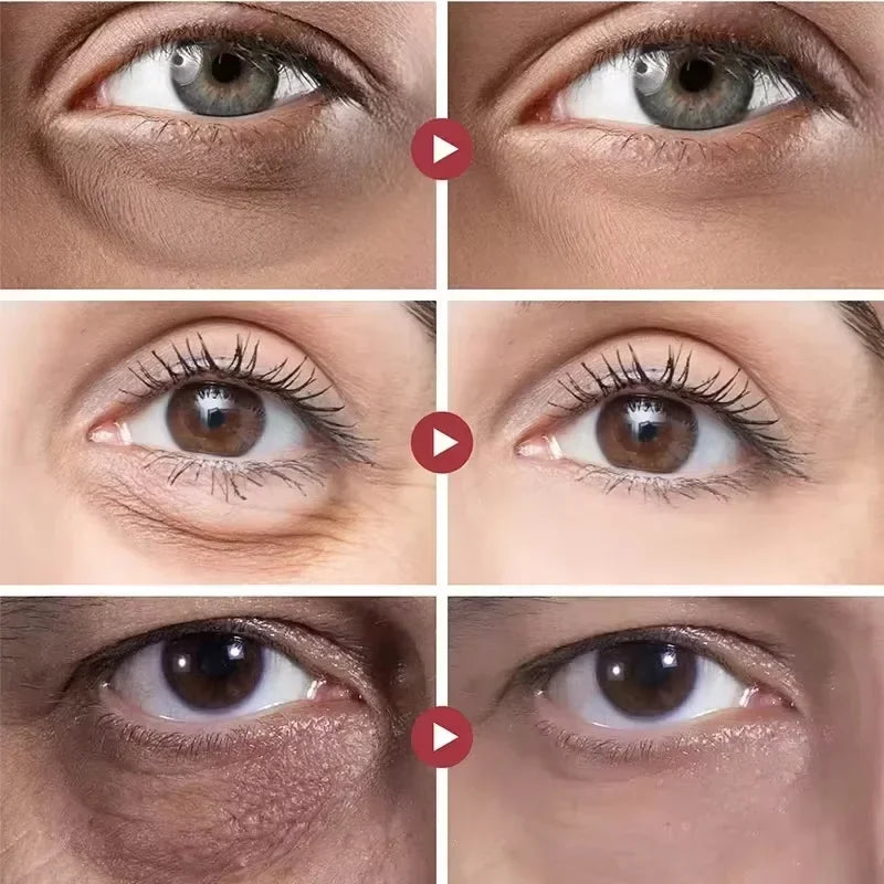 Instantly removes under eye bags, reduces fine wrinkles, improves skin elasticity, eliminates dark circles, brightens the eye ar