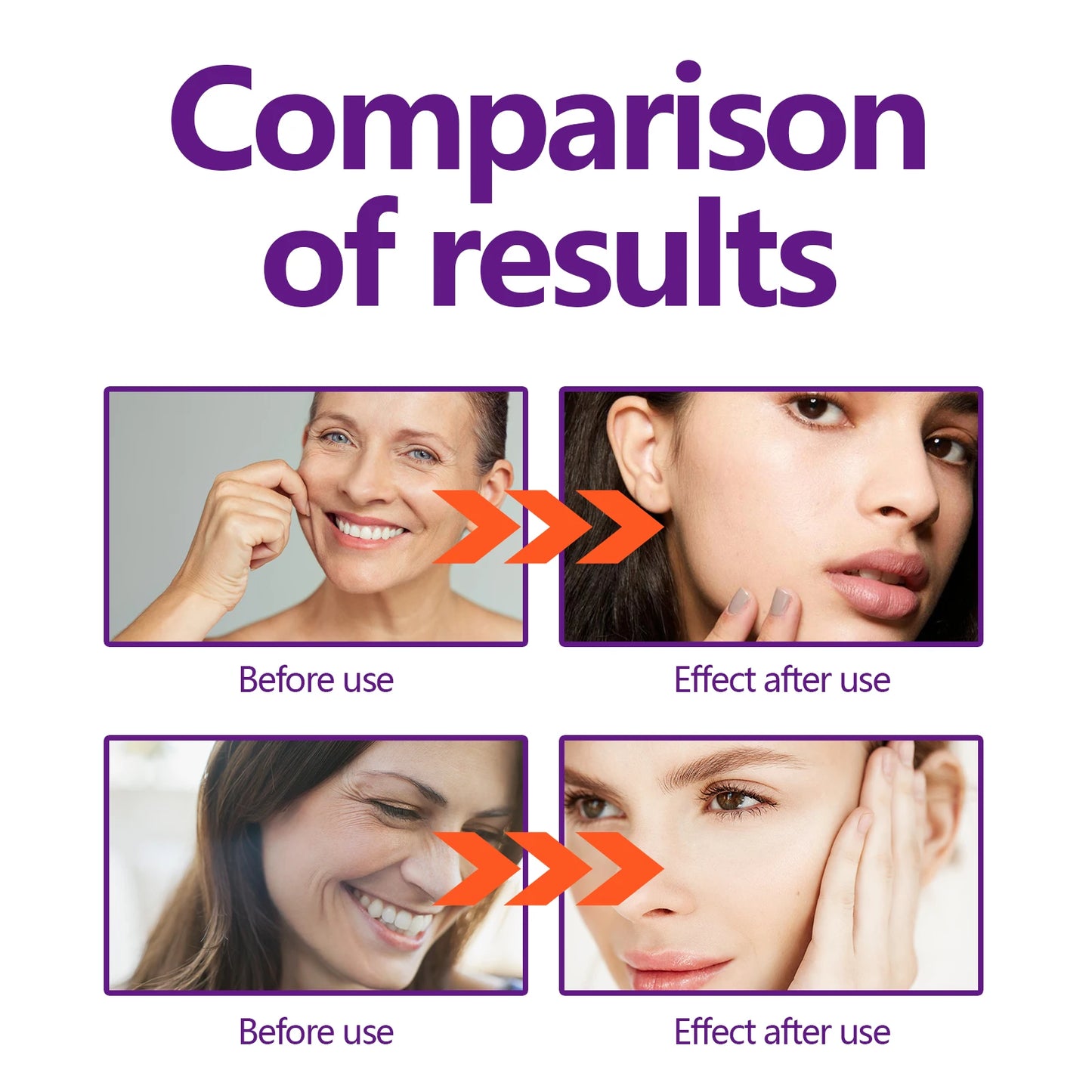 Hoygi Face Lifting Cream 30ml Face Moisturizer Wrinkle Reduction Firming Hydration Winter Skincare Dull Skin Treatment